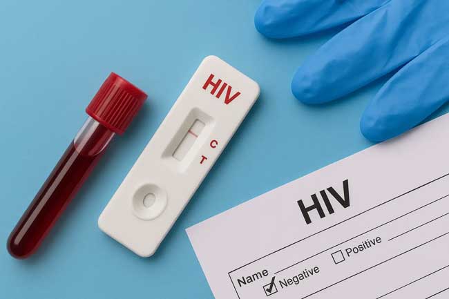 HIV HIV
